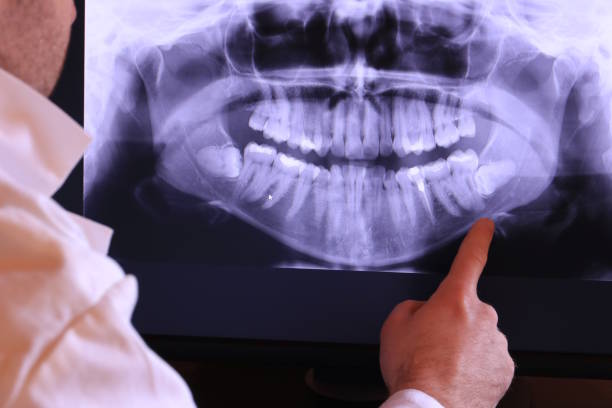Best Urgent Tooth Repair  in Somersworth, NH